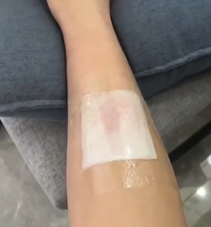 密封湿敷（带注射器的）