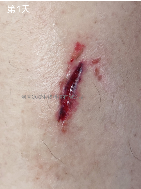 939d8165-21e2-43bf-aef9-2fe45bf72e91.png