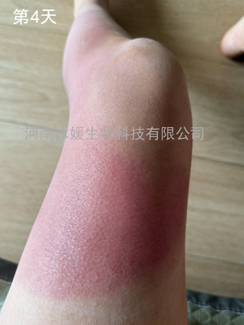 32ed3e62-ec65-420e-ad55-0fe83e439be8.png