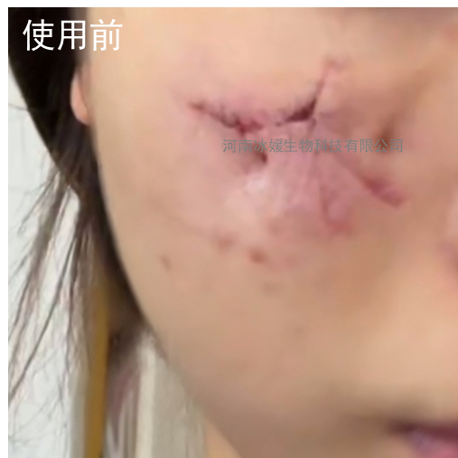 面部划伤