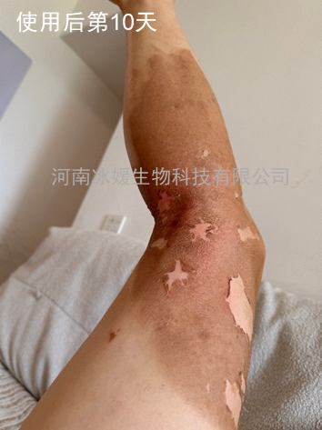 b2a01ff2-3f9d-4371-adfd-d532d70dcc99.png