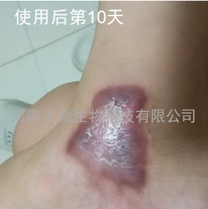 b254b093-f55c-45a7-b085-b1934adec071.png