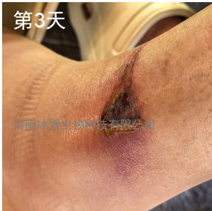 f369291b-6743-4d1d-aa0d-24c1ead3a952.png