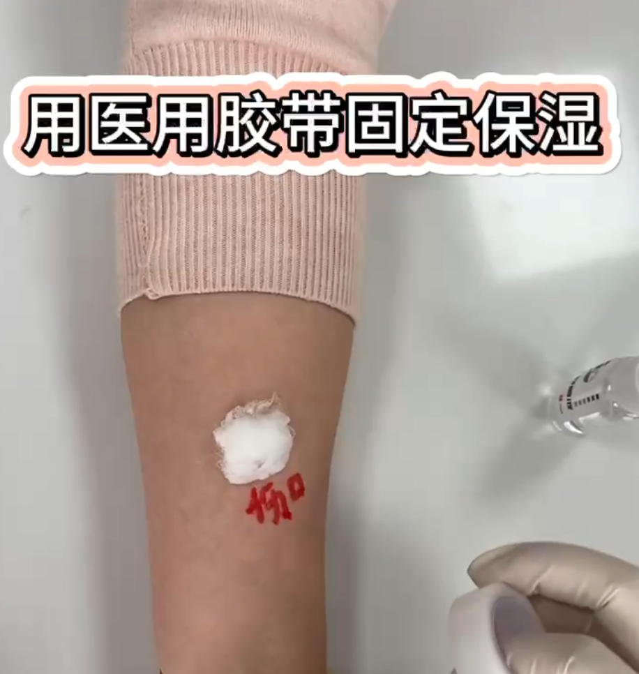 透气湿敷