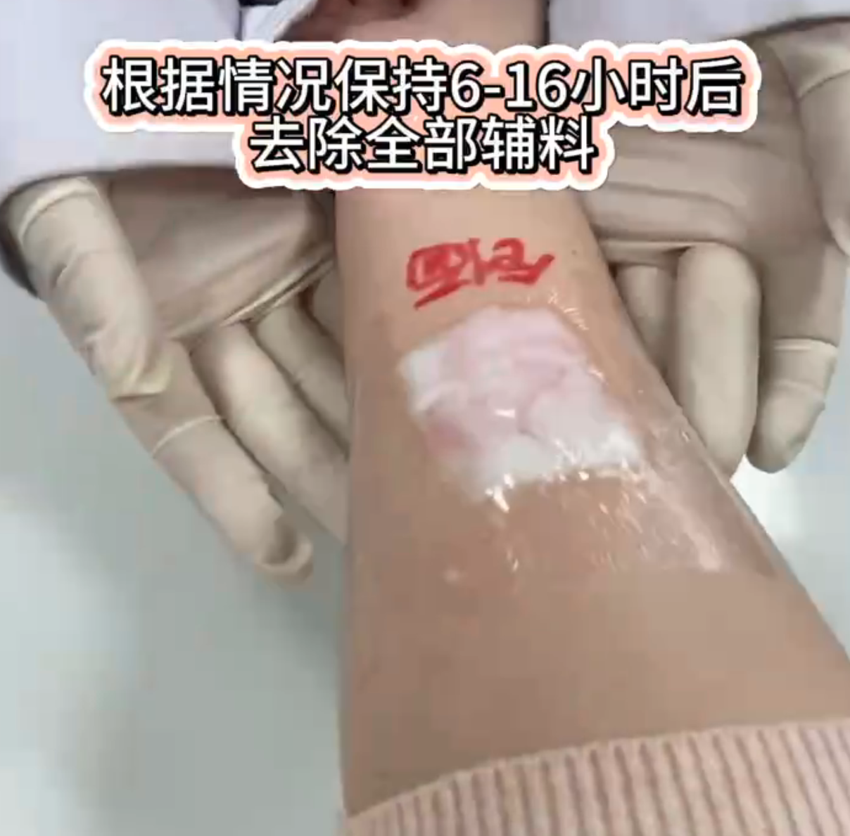 密封湿敷