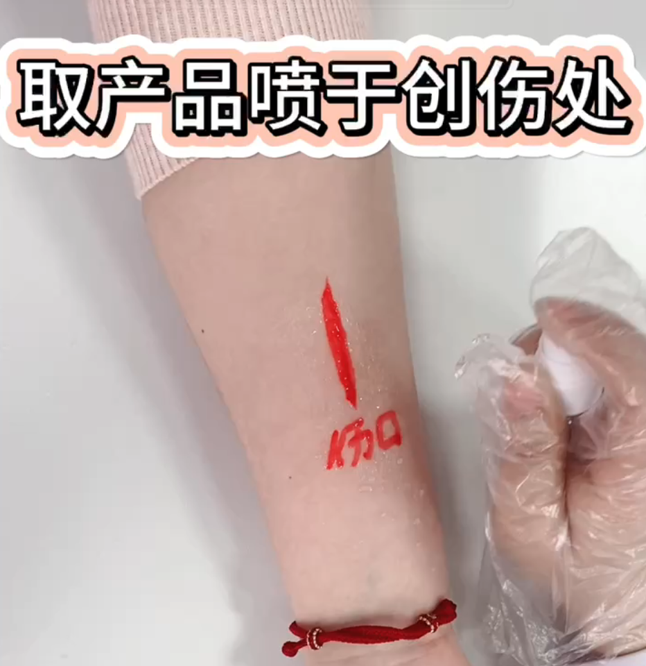 喷雾