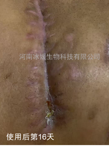 5785c161-56c0-4dde-864a-cf401c4a40d1.png