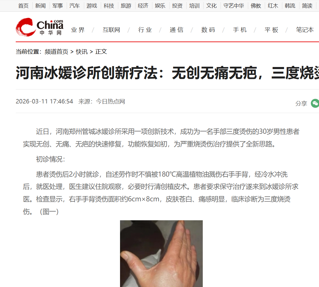河南冰媛诊所创新疗法：无创无痛无疤，三度烧烫伤快速修复