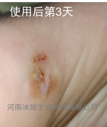 5237fdcb-9b7a-4679-b45e-51fe303b1c1e.png