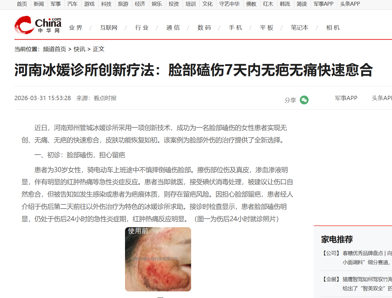 河南冰媛诊所创新疗法：脸部磕伤7天内无疤无痛快速愈合