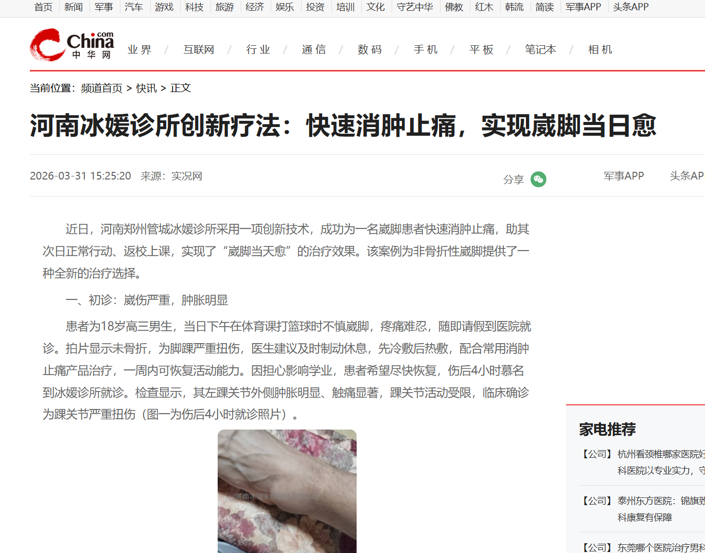 河南冰媛诊所创新疗法：快速消肿止痛，实现崴脚当日愈