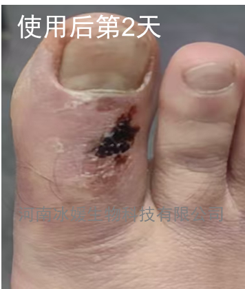 884e6a1d-2a65-4318-b154-d7eeb1005095.png