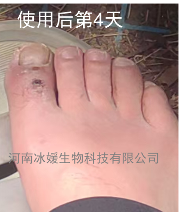 2ac58579-447d-4a1d-bb89-ff4dcd81198d.png