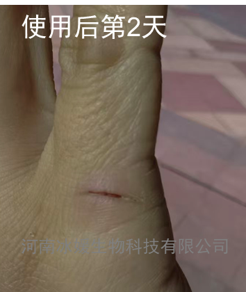 78d22709-da3a-48b3-b483-61f3b1f67b10.png