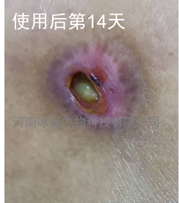 3e0c5ef5-0b62-487a-871a-950996b1e5ef.png
