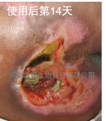 13b6fc14-4abf-4e15-a478-6a5fd6455bd4.png