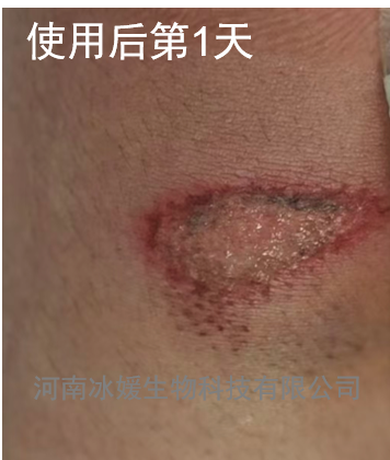 adb1427c-2034-4188-afb1-f20bbd82e592.png