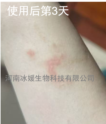 f57d9eaf-057d-4fe6-9076-f004254dff25.png