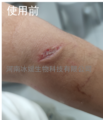 cbf7e812-518c-4661-9827-4a65f7e62116.png