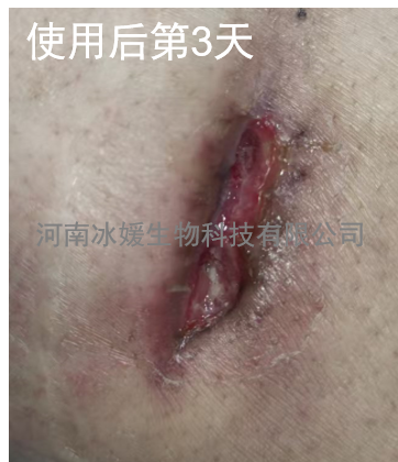b4486fd7-60c0-4170-aefd-74b66937f0e6.png
