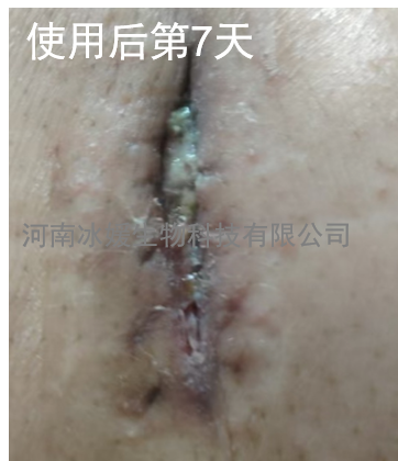 956023fd-1d4a-4ccf-8880-eba1ef752447.png