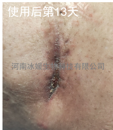 bd99a433-ed08-4bb8-a54c-2352cead41bb.png