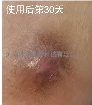 e4a8d103-3ef6-403e-8e74-2e564080bd35.png