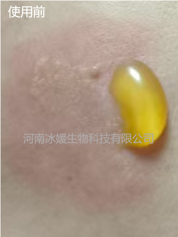 3a010181-dd61-4ee8-ab48-2065c9c70708.png