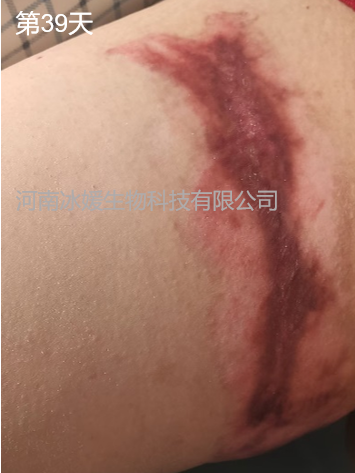 9301c96c-6f6c-4c22-aa75-631450acde13.png