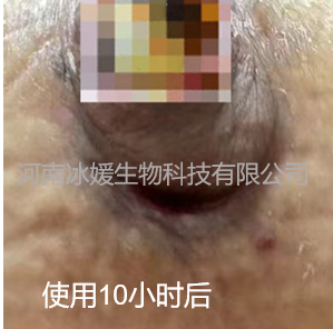 44d0a283-06dd-4be0-83f5-2498df62b1c4.png