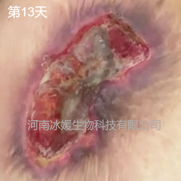d2b5c21d-f59b-4798-8726-56c2c82cf8ff.png