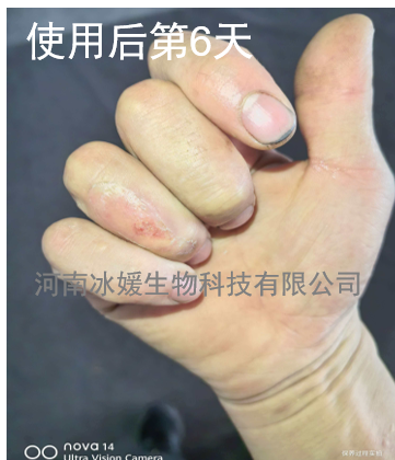 483aa3af-9b5c-49af-ad22-f18c5df4afcb.png