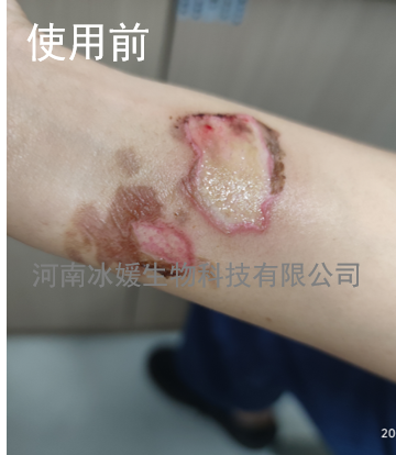 df65a171-16d4-41a1-a011-2b6444765826.png