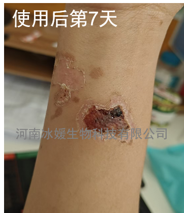 7e813a3c-3d6a-445a-8bed-c3322862e10f.png