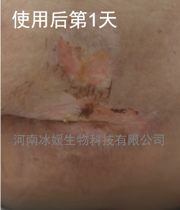 75cd7201-995e-4913-9fac-0b193d1f9cd9.png