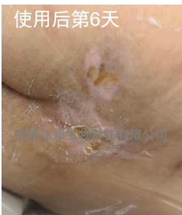 85b97a66-f865-4916-a862-ecd310932ec9.png
