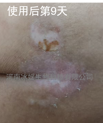 bba9fa9c-24be-4599-b17e-65c47879eaf2.png