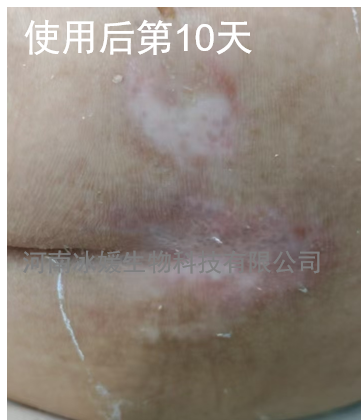 c48df400-f8c8-4b5f-9b39-349ebd73f425.png