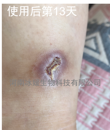9d390e08-3776-4136-a177-091da72dfffb.png
