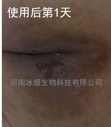 4bdfbcef-c35a-4f53-9945-fef783d00273.png