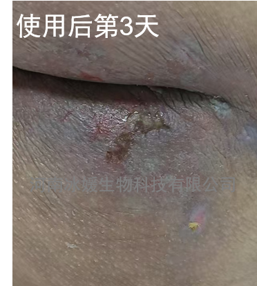 181f5965-3fbd-4144-9317-e27cf924f795.png