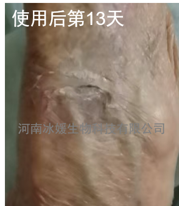 d1acce4c-3530-47a8-8485-20bd3c7eb594.png