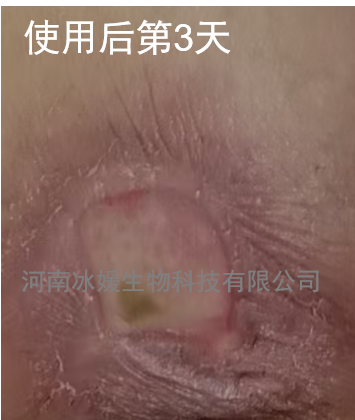 ba3d8151-789b-4c77-93d5-269436b14196.png