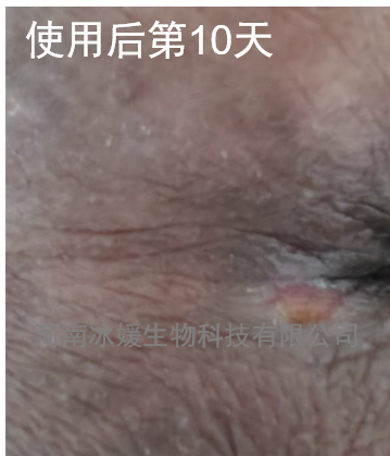 0ddb02be-456b-4a2a-895d-7cb44852045a.png