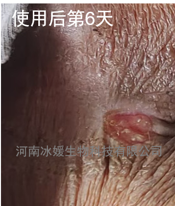 17e23f49-5a3a-4265-b916-c1e4bcdf0f61.png
