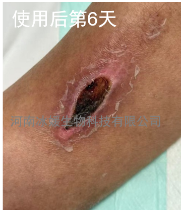 a4844522-0294-455f-b6d5-d7b8018a36b0.png