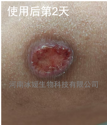 870cf2e9-cc97-4481-8e15-d18f37ba5c71.png