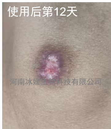 760af19c-99d2-45ef-bce8-8c1295fb13f2.png
