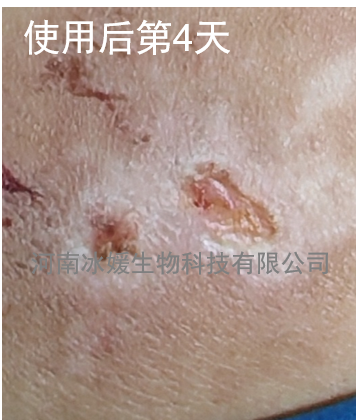 a9de2119-a8f1-44c3-a819-80c753c05562.png