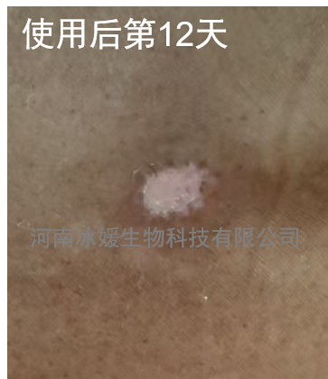 fb857437-e178-4fc9-9f91-64f00b0e4c25.png